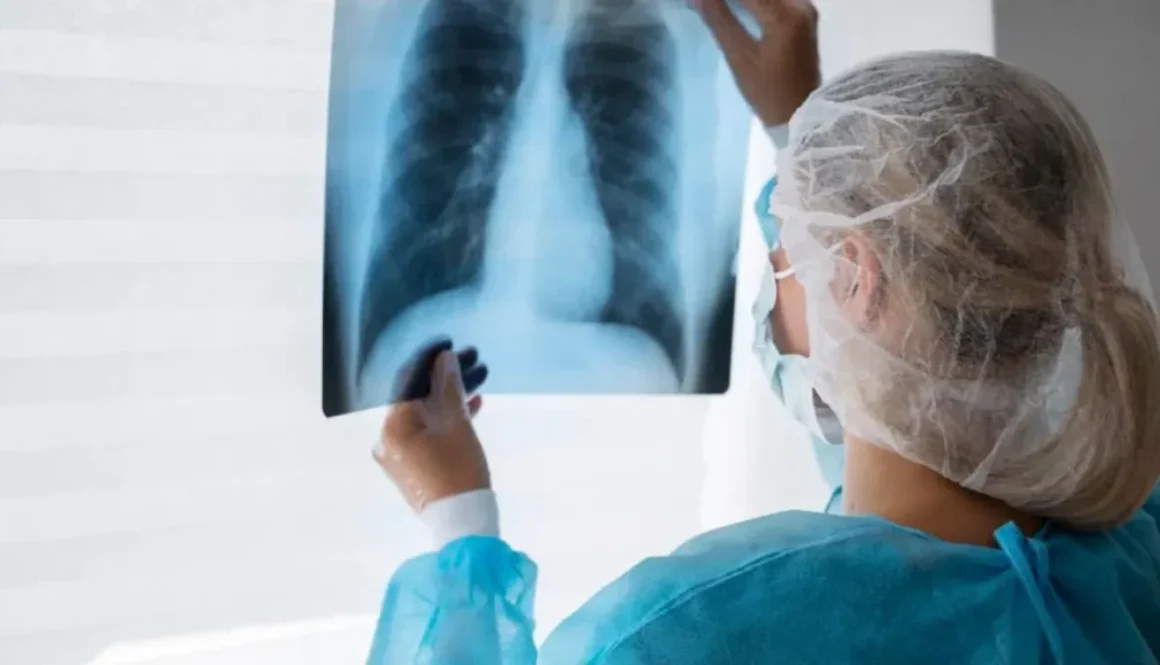 cancer-de-pulmon-caracteristicas